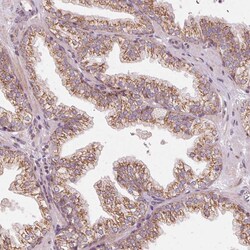 Invitrogen TOM70 Polyclonal Antibody 100 &mu;L; Unconjugated:Antibodies,