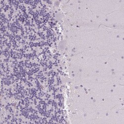 Invitrogen FCRL3 Polyclonal Antibody 100 &mu;L; Unconjugated:Antibodies,