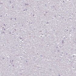 Invitrogen FCRL3 Polyclonal Antibody 100 &mu;L; Unconjugated:Antibodies,
