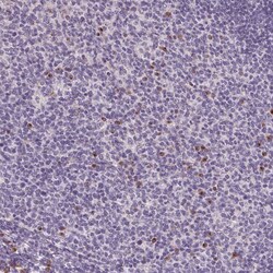 Invitrogen FCRL3 Polyclonal Antibody 100 &mu;L; Unconjugated:Antibodies,