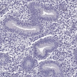 Invitrogen C13orf28 Polyclonal Antibody 100 &mu;L; Unconjugated:Antibodies,