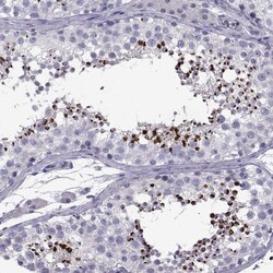 Invitrogen C13orf28 Polyclonal Antibody 100 &mu;L; Unconjugated:Antibodies,