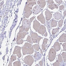 Invitrogen&trade;&nbsp;MRP3 Polyclonal Antibody