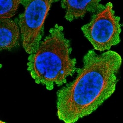 HDAC8 Polyclonal Antibody:Antibodies, Polyclonal