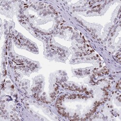 HDAC8 Polyclonal Antibody:Antibodies, Polyclonal