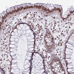 HDAC8 Polyclonal Antibody:Antibodies, Polyclonal