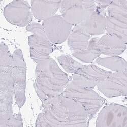 HDAC8 Polyclonal Antibody:Antibodies, Polyclonal