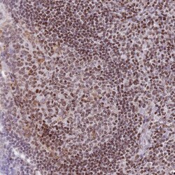 HDAC8 Polyclonal Antibody:Antibodies, Polyclonal