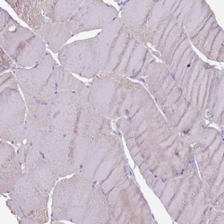 Invitrogen STYK1 Polyclonal Antibody 100 &mu;L; Unconjugated:Antibodies,