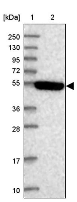 Invitrogen STYK1 Polyclonal Antibody 100 &mu;L; Unconjugated:Antibodies,