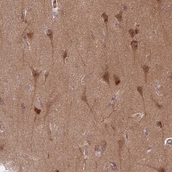 GUK1 Polyclonal Antibody:Antibodies, Polyclonal