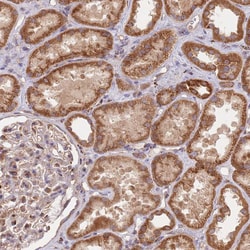 GUK1 Polyclonal Antibody:Antibodies, Polyclonal