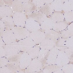 GUK1 Polyclonal Antibody:Antibodies, Polyclonal