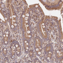 GUK1 Polyclonal Antibody:Antibodies, Polyclonal