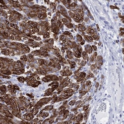 Invitrogen Melan-A Polyclonal Antibody 100 &mu;L; Unconjugated:Antibodies,