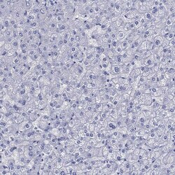 Invitrogen Melan-A Polyclonal Antibody 100 &mu;L; Unconjugated:Antibodies,