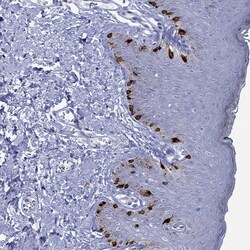 Invitrogen Melan-A Polyclonal Antibody 100 &mu;L; Unconjugated:Antibodies,