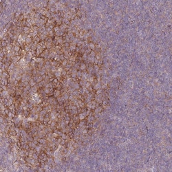 Invitrogen RFTN1 Polyclonal Antibody 100 &mu;L | Buy Online | Invitrogen&trade; | Fisher Scientific