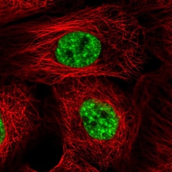 Invitrogen RED Polyclonal Antibody 100 &mu;L; Unconjugated:Antibodies,