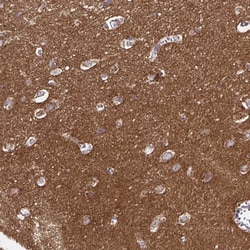 Invitrogen LFG Polyclonal Antibody 100 &mu;L; Unconjugated:Antibodies,