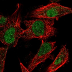 Invitrogen MDMX Polyclonal Antibody 100 &mu;L; Unconjugated:Antibodies,