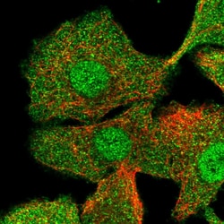 Invitrogen Calmyrin Polyclonal Antibody 100 &mu;L; Unconjugated:Antibodies,