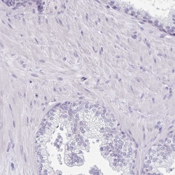 Invitrogen CaV1.1 Polyclonal Antibody 100 &mu;L; Unconjugated:Antibodies,