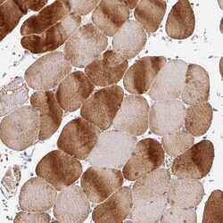 Invitrogen CaV1.1 Polyclonal Antibody 100 &mu;L; Unconjugated:Antibodies,
