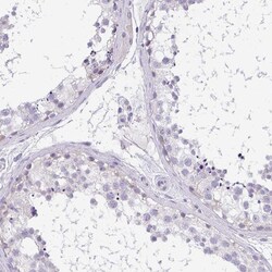 Invitrogen CaV1.1 Polyclonal Antibody 100 &mu;L; Unconjugated:Antibodies,