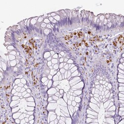 Invitrogen CD68 Polyclonal Antibody 100 &mu;L; Unconjugated:Antibodies,