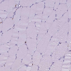 Invitrogen CD68 Polyclonal Antibody 100 &mu;L; Unconjugated:Antibodies,