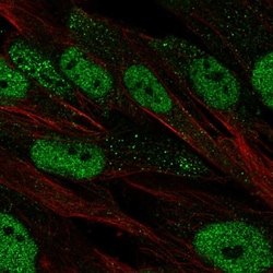 Invitrogen Oct-2 Polyclonal Antibody 100 &mu;L; Unconjugated:Antibodies,