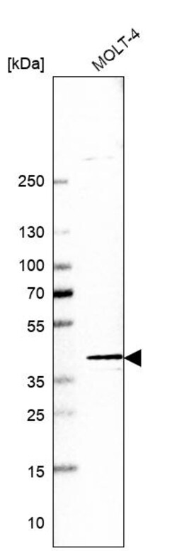 Invitrogen POLB Polyclonal Antibody 100 &mu;L | Buy Online | Invitrogen&trade; | Fisher Scientific