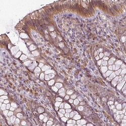 CD205 Polyclonal Antibody:Antibodies, Polyclonal