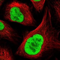 Invitrogen RFC4 Polyclonal Antibody 100 &mu;L; Unconjugated:Antibodies,
