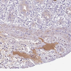 Complement Factor H Polyclonal Antibody:Antibodies, Polyclonal