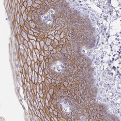 Invitrogen Desmocollin 3 Polyclonal Antibody 100 &mu;L; Unconjugated:Antibodies,