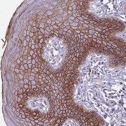Invitrogen Desmocollin 3 Polyclonal Antibody 100 &mu;L; Unconjugated:Antibodies,