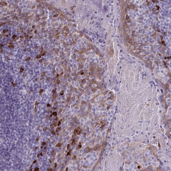 Invitrogen Desmocollin 3 Polyclonal Antibody 100 &mu;L; Unconjugated:Antibodies,