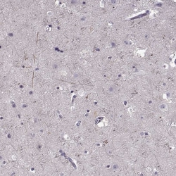 CNGA3 Polyclonal Antibody:Antibodies, Polyclonal