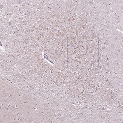 CNGA3 Polyclonal Antibody:Antibodies, Polyclonal