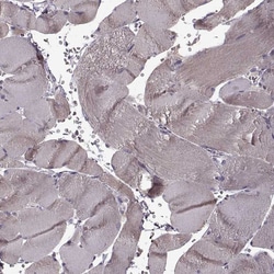 CNGA3 Polyclonal Antibody:Antibodies, Polyclonal