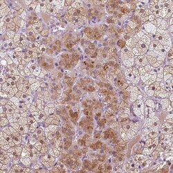 Invitrogen KRT71 Polyclonal Antibody 100 &mu;L; Unconjugated:Antibodies,