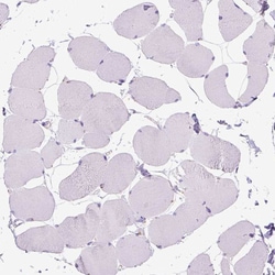 Invitrogen KRT71 Polyclonal Antibody 100 &mu;L; Unconjugated:Antibodies,