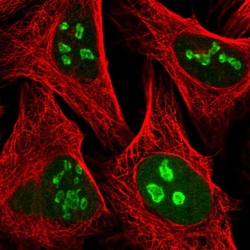Invitrogen PAPSS1 Polyclonal Antibody 100 &mu;L; Unconjugated:Antibodies,