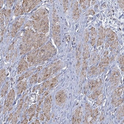Invitrogen PAPSS1 Polyclonal Antibody 100 &mu;L; Unconjugated:Antibodies,