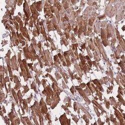 POM121 Polyclonal Antibody:Antibodies, Polyclonal