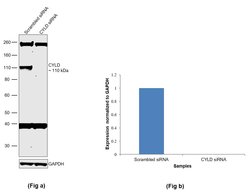 Invitrogen CYLD Polyclonal Antibody 100 &mu;L; Unconjugated:Antibodies,