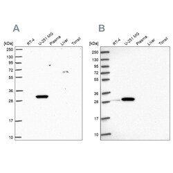 Invitrogen RPL8 Polyclonal Antibody 100 &mu;L; Unconjugated:Antibodies,