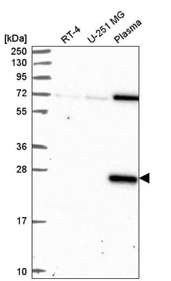 Invitrogen Dectin 1 (soluble) Polyclonal Antibody 100 &mu;L; Unconjugated:Antibodies,